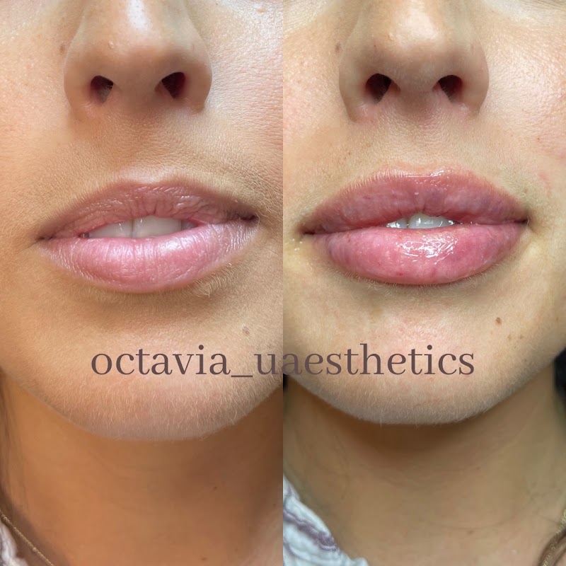 Illustration of OctaviaUAesthetics, spa in Lufkin, TX, photo 1 of 5
