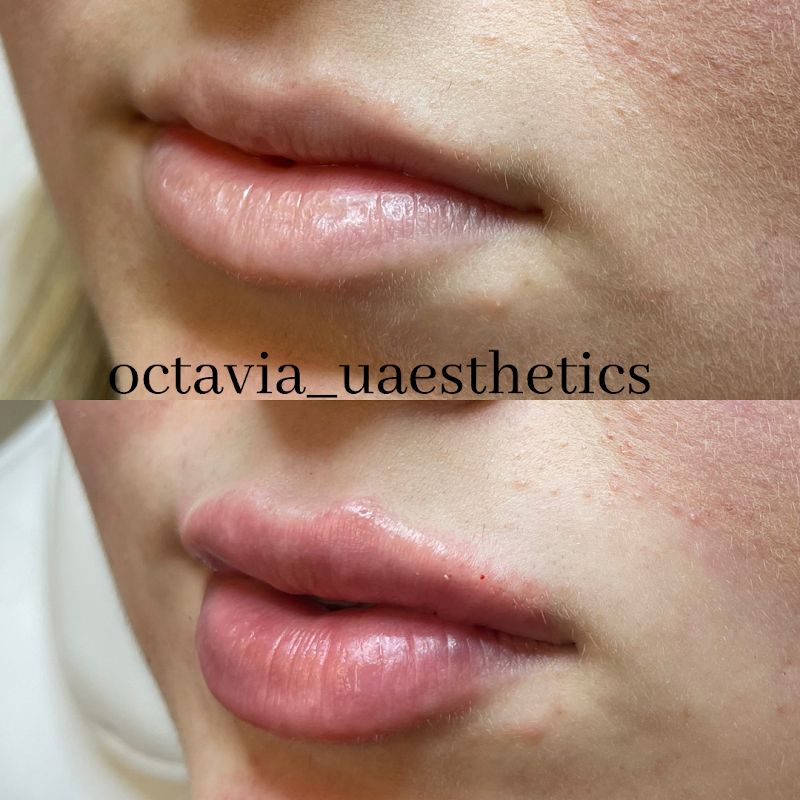 Illustration of OctaviaUAesthetics, spa in Lufkin, TX, photo 2 of 5
