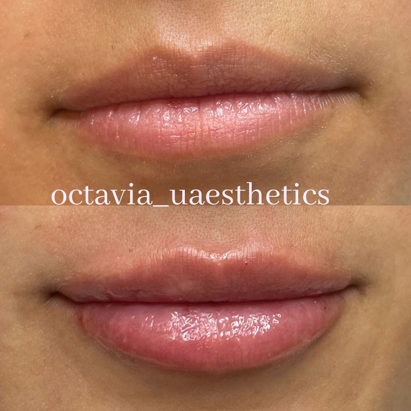 Illustration of OctaviaUAesthetics, spa in Lufkin, TX, photo 5 of 5